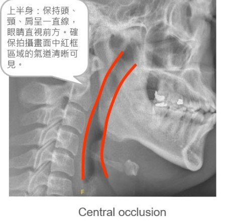 口內呼吸道影像